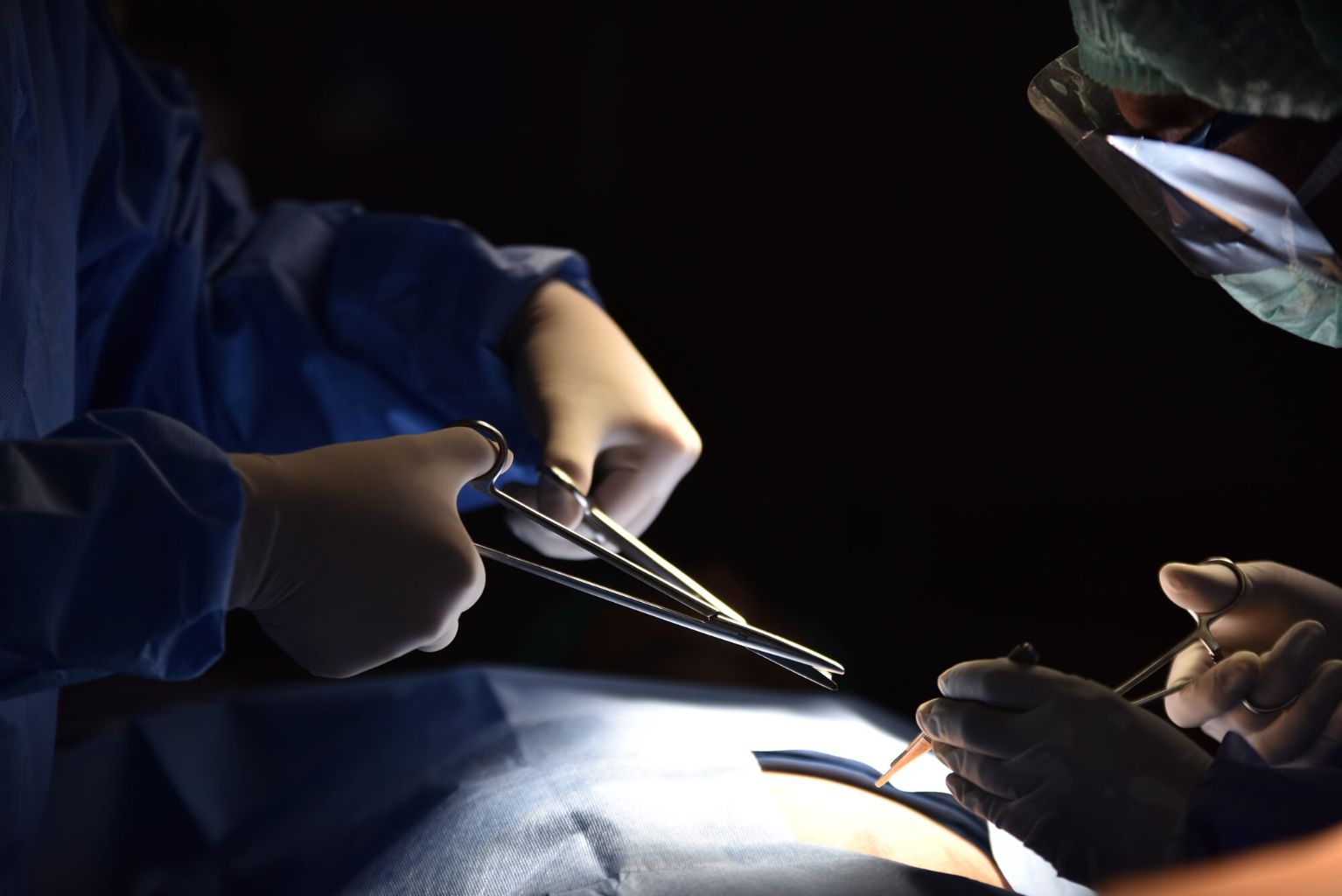 תמונת נושא של המאמר רשלנות רפואית בניתוח לב פתוח בו המציגה שני מנתחים בחדר ניתוח. אחד מחזיק מספריים גדולים, והשני מבצע חתך קטן בעזרת אזמל כירורגי. שניהם לובשים כפפות, וכיסויים כחולים, והאור ממוקד על אזור הניתוח כששאר החדר חשוך.